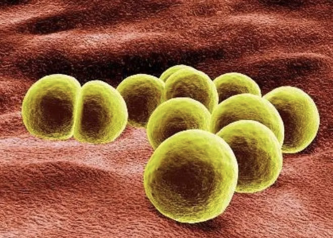 Staphylococcus aureus